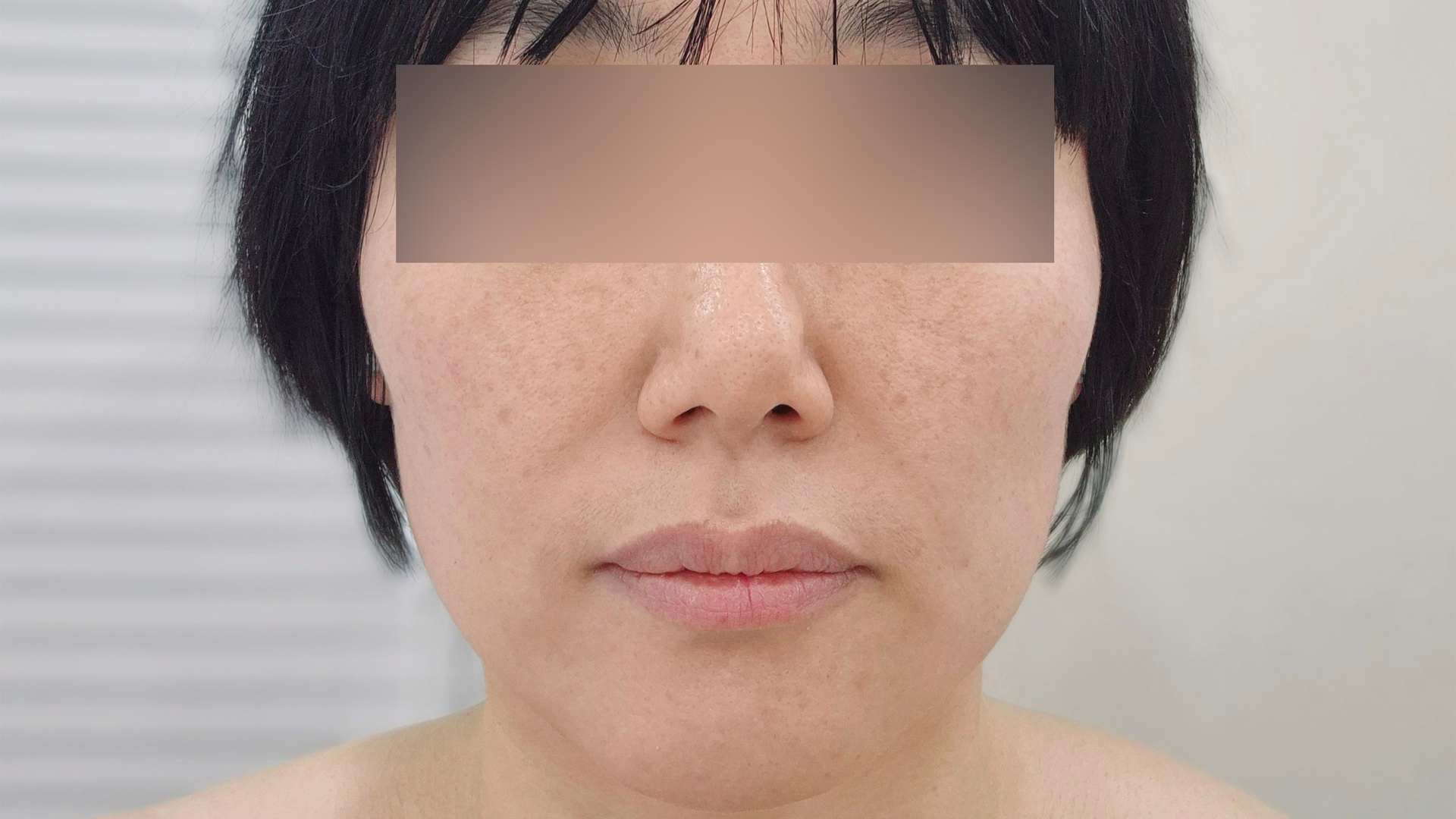 예시-1
